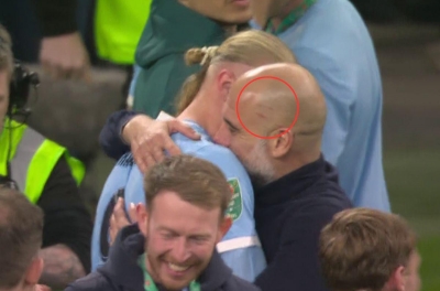 佩普·瓜迪奥拉再次出现头部擦伤痕迹